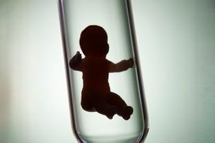 体外受精 IVF-ET